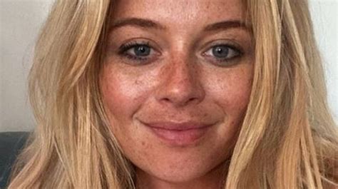 Emily Atack Shows Off Stunning Natural Freckles After Ibiza Holiday