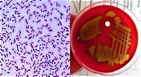 Morphology And Culture Characteristics Of Streptococcus Pneumoniae