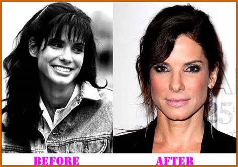 Sandra Bullock Plastic Surgery Before And After Nose Job And Botox