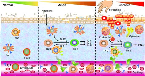 Skin During The Acute And Chronic Stages Of Immune Cell Migration And
