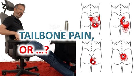 Your Sitting Posture Can Cause Tailbone Pain Gluteus And Multifidi Muscles Youtube