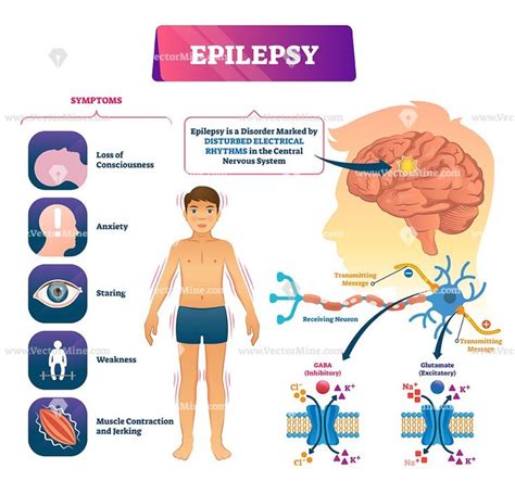Epilepsy Vector Illustration Vectormine Epilepsy Epilepsy Facts