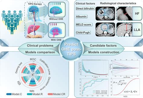 Preoperative Prediction Of Overt Hepatic Encephalopathy Caused By
