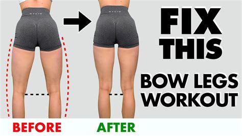 10 Min Bow Legs Home Workout Fix Bow Legs In 10 Minday Youtube