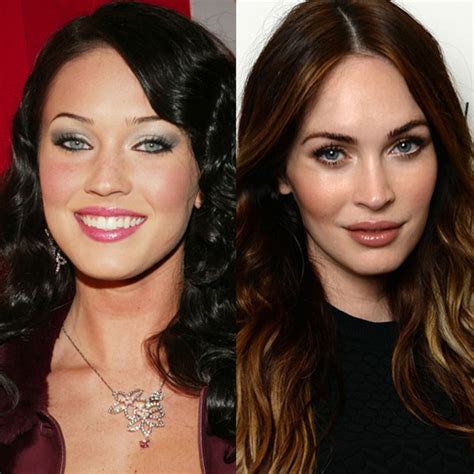 Photos From Celebs Who Deny Getting Plastic Surgery