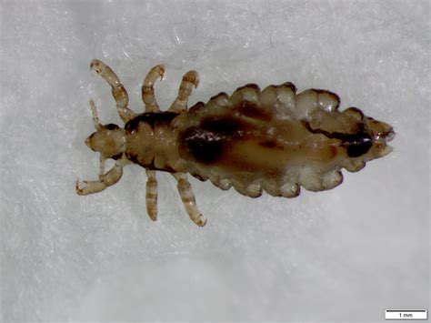 Can Lice Eggs Hatch On Carpet