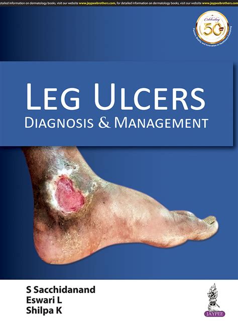Leg Ulcers Diagnosis And Management Buy Leg Ulcers Diagnosis And