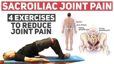 Sacroiliac Joint Dysfunction