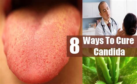 8 Effective Treatments To Cure Candida Herbal Supplements