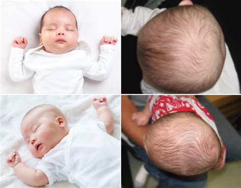 Preventing Baby Flat Head Health Information