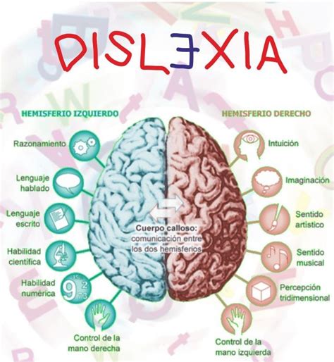 Tipos De Dislexia Según La Ruta Alterada Avanzo Sesma Psicología