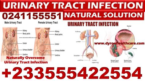 How To Treat Urinary Tract Infection UTI Naturally Health Articles