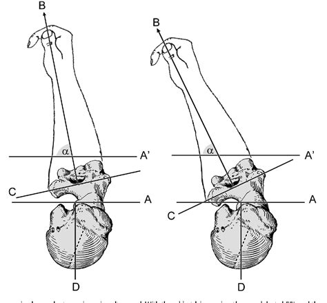 Pdf Humeral Torsion And Throwing Proficiency In Early Human Evolution