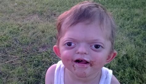 Mom Responds To Bullies Who Made Cruel Meme Of Son With Rare Disorder