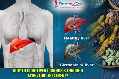 Cure Liver Cirrhosis Through Ayurvedic Treatment Doctor2care