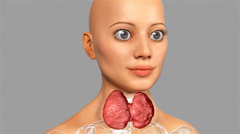 Diffuse Toxic Goiter Graves Disease