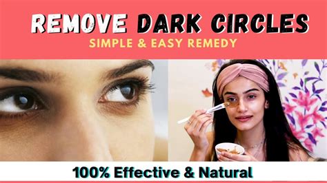 Dark Circles Under Eyes Home Remedy Remove Dark Circles Dark