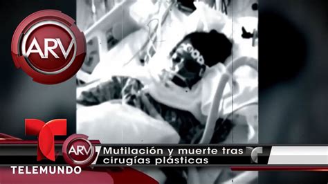 Mutilación y muerte tras cirugías plásticas Al Rojo Vivo Telemundo YouTube