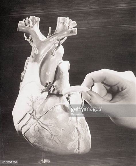Artificial Heart Valve Photos And Premium High Res Pictures Getty Images