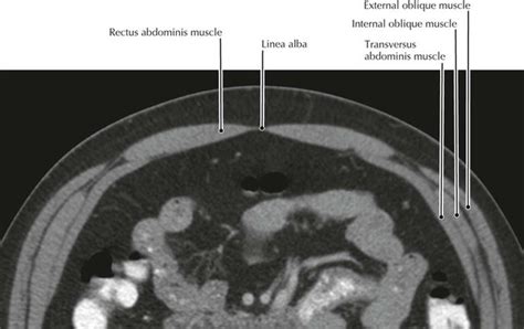 Abdomen Radiology Key