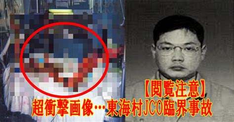 【閲覧注意】超衝撃画像東海村jco臨界事故「被爆治療83日の記録」画像あり Hachibachi
