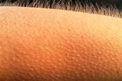 Goosebumps Skin Why We Get Goosebumps In Our Body Rogers Wisdom