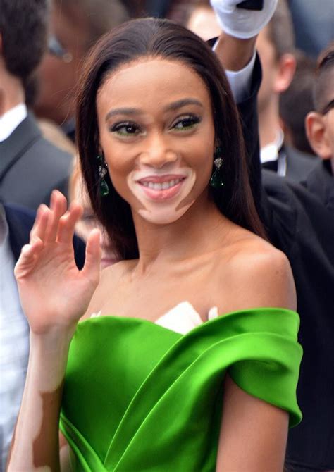 Winnie Harlow Celebrity Biography Zodiac Sign And Famous Quotes