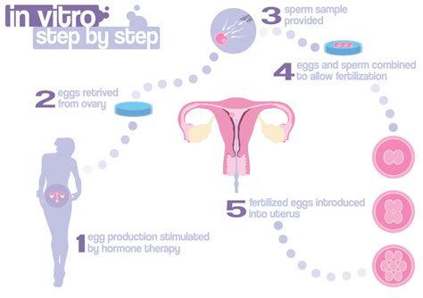 The 4 Stages Of Ivf Treatment Cycle In Mumbai To Get Pregnant