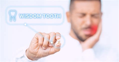Signs And Symptoms Of Impacted Wisdom Teeth Trafalgar Dental Oakville
