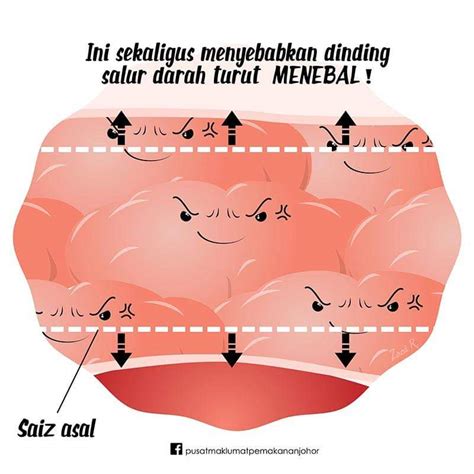 Tekanan darah tinggi atau yang lebih dikenal dengan istilah hipertensi merupakan sebuah kondisi dimana tekanan darah pada dinding arteri mengalami peningkatan. Mrs Pip || The Reviewer