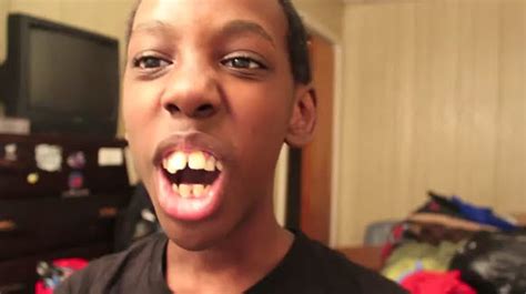 His Teeth Though The Most Messed Up Teeth Ever Video