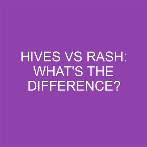 Hives Vs Rash What S The Difference Differencess