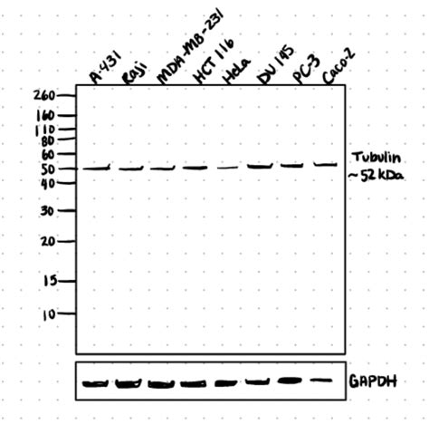 Western Blot Exposure Time And Detection Protocols And Techniques