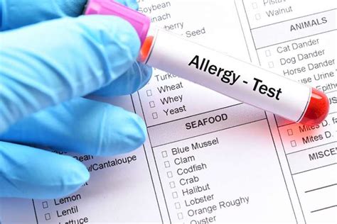 People with a food intolerance have difficulty digesting certain foods. Insect Stings Allergy