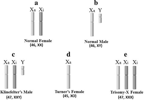 Autoimmune Diseases And Karyotypes A The Normal Female Karyotype Download Scientific Diagram