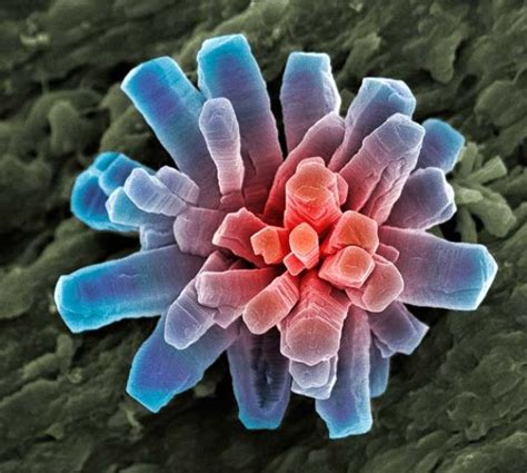 Amazing Scanning Electron Microscope Pictures 24 Pics
