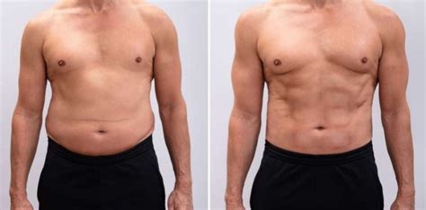 How To Lose Belly Fat For Men Simple Tips Backed By Science Name