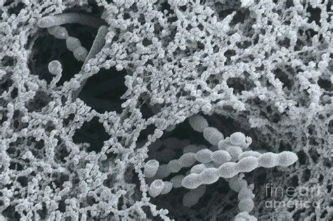 Bacteria In Yogurt Photograph By Scimat Pixels