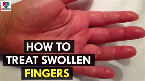 How To Treat Swollen Fingers Health Sutra Youtube