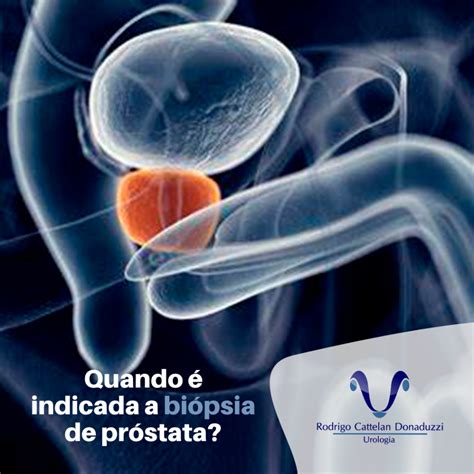 Liquido Saindo Do Penis