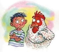• chicken pox = varicella = cacar air. KONSTANTIN: Chicken Pox