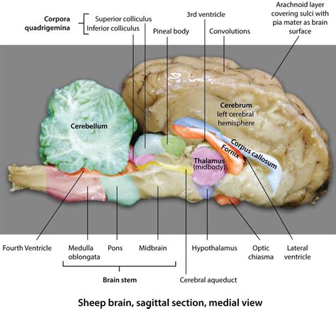 Sheep Brain Sagittal Section Medial View Brain