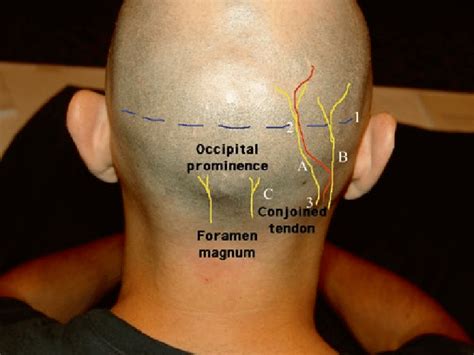 Greater Occipital Nerve Innervation