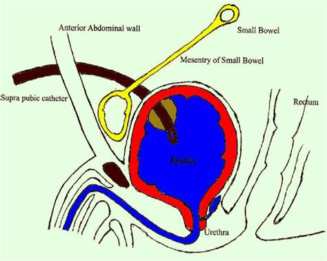 Emergency Procedures Supra Pubic Catheterization Tracheostomy Central