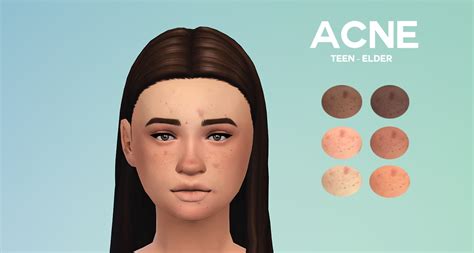 Boredsimblr Acne Sims 4 The Sims 4 Skin Sims 4 Teen