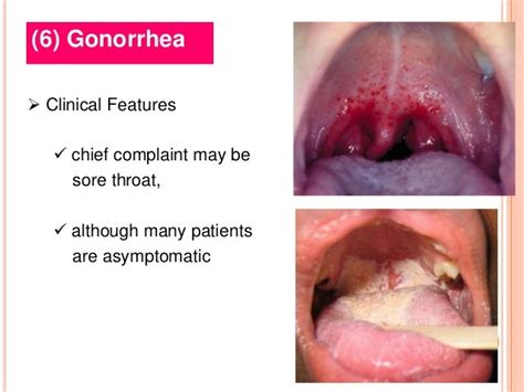 Bacterial Infections 4