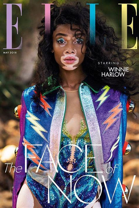 Winnie Harlow Is The Cover Star Of Elle Uk May 2018 Issue Fashion