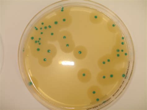 Listeria Monocytogenes Laboratoire Vigilab Agroalimentaire Hydrologie