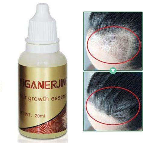 20ml 100 Natural Ginger Hair Growth Essential Oil Liquid Hair Loss Products Leave In Hair