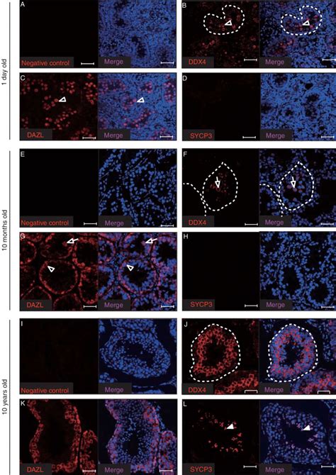 Testisis mяичко, семенникis m, fочевидецсвидетель. Immunohistochemical analyses of germ cell markers in ...